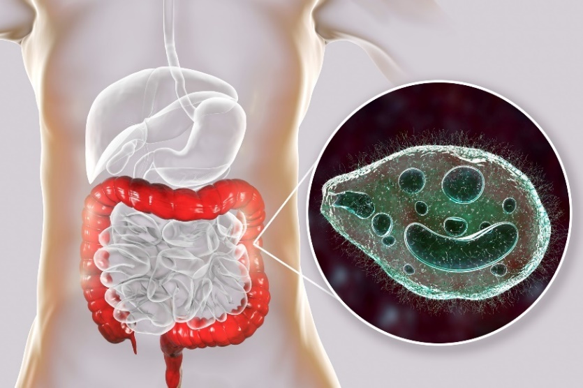 Balantidium coli - паразит, заразяващ дебелото черво на човешкия храносмилателен тракт