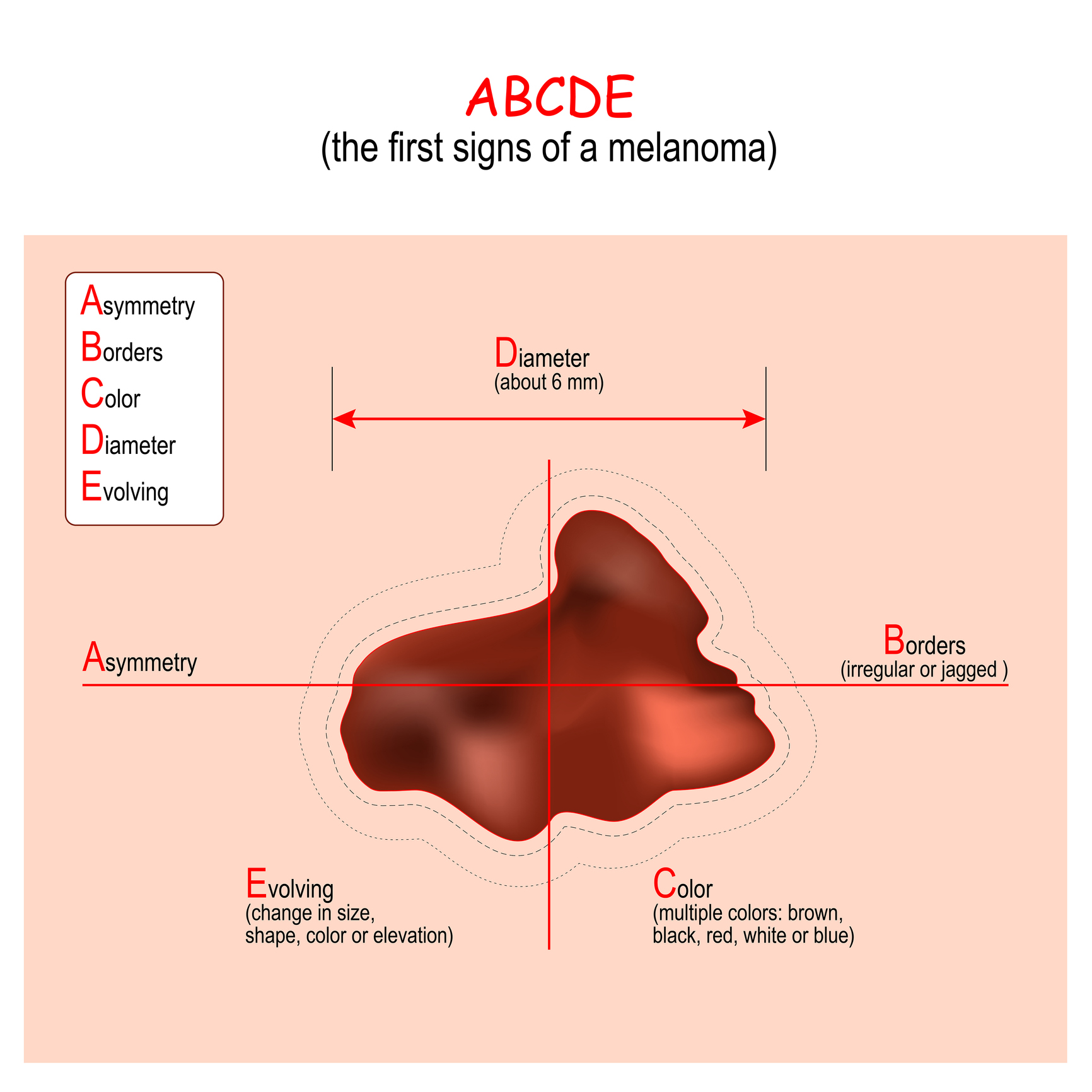 Алгоритъм ABCDE